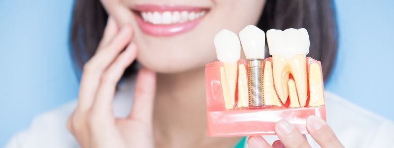 Are Dental Implants Painful