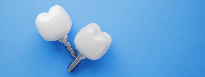 Do Gums Grow Around Implants