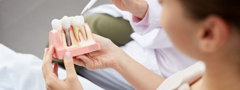 What is the best age for a dental implant