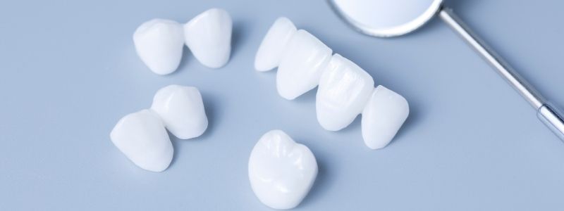 How Much Do Porcelain Veneers Cost